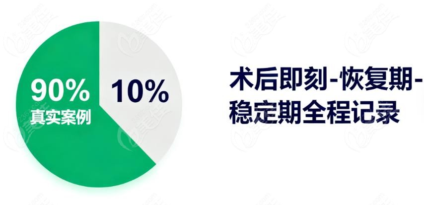那剩下的10%“水分”在哪