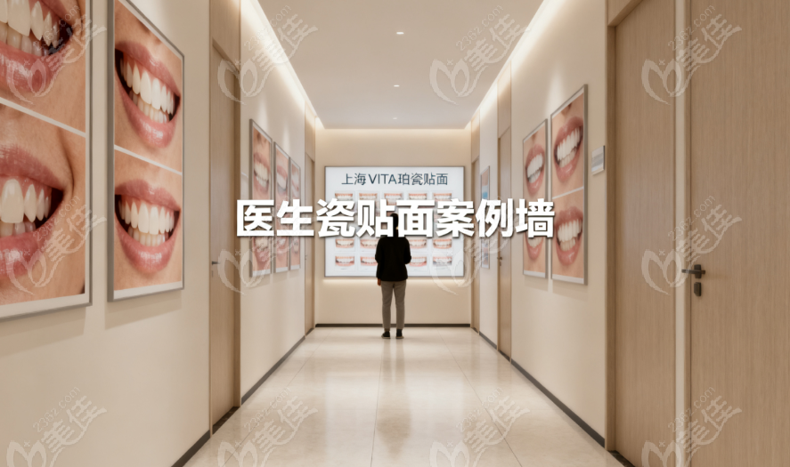上海做Vita琥珀瓷贴面较好的口腔诊所