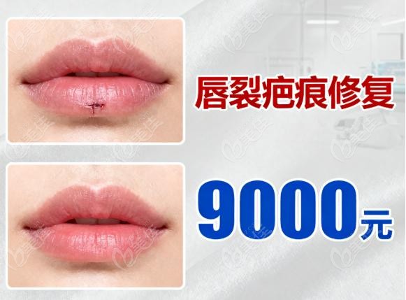 潘柏林疤痕修复多少钱