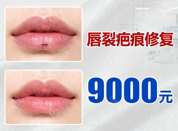 潘柏林疤痕修复怎么样