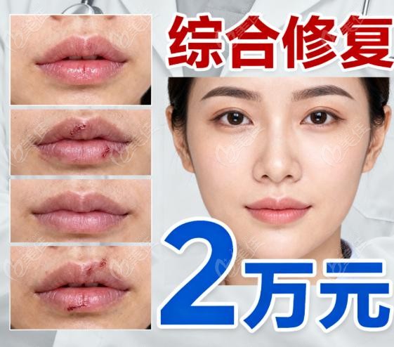 潘柏林疤痕修复真人实例