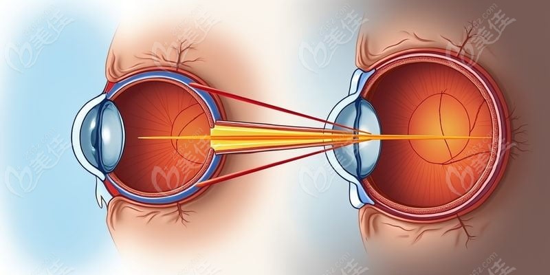 二、不同手術(shù)項目對比