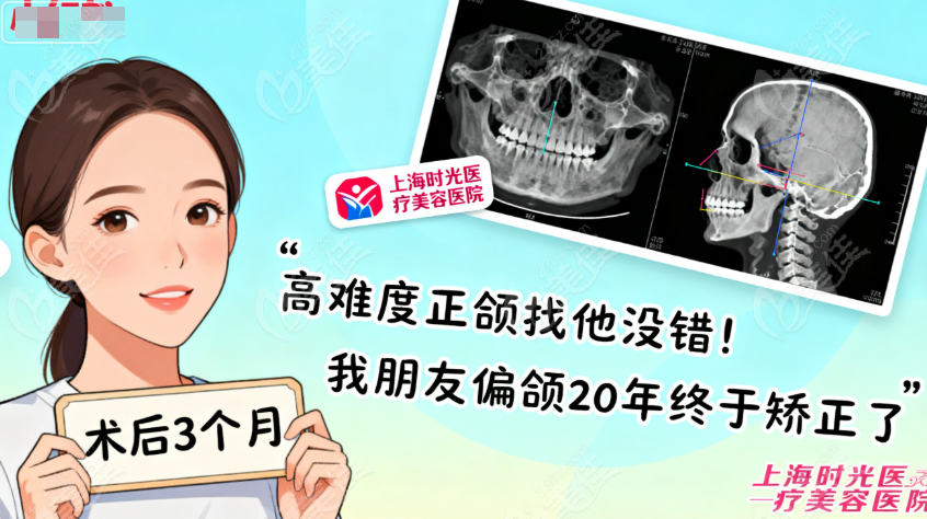 穆雄铮正颌手术的患者评价