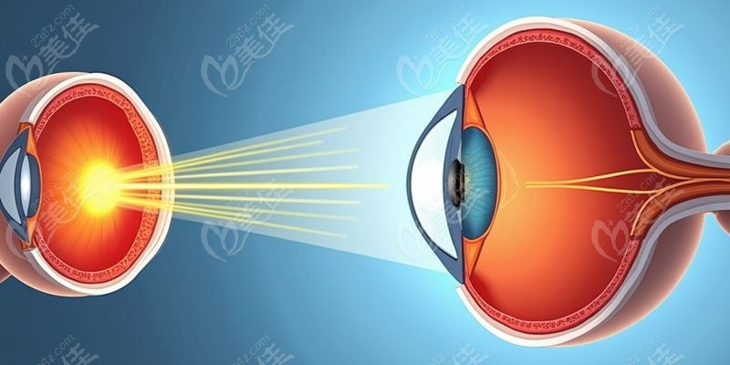 四、華西醫(yī)院眼科白內(nèi)障就診指南