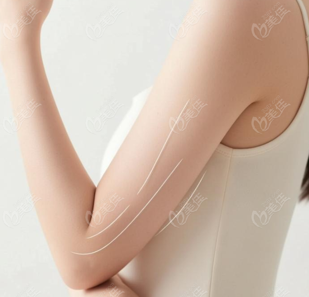 選擇大連沙醫(yī)生做手臂吸脂