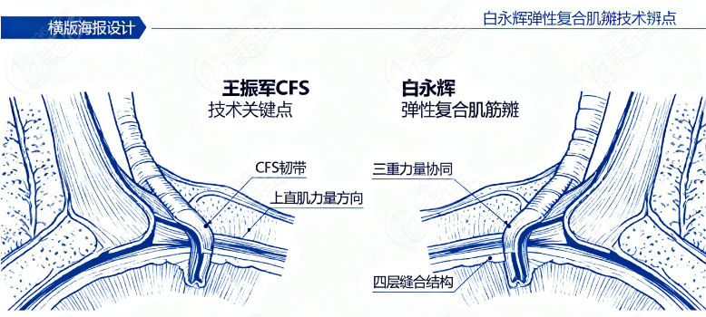 王振军和白永辉眼睛上睑下垂修复谁更腻害