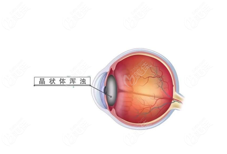 截图20231201191923.png