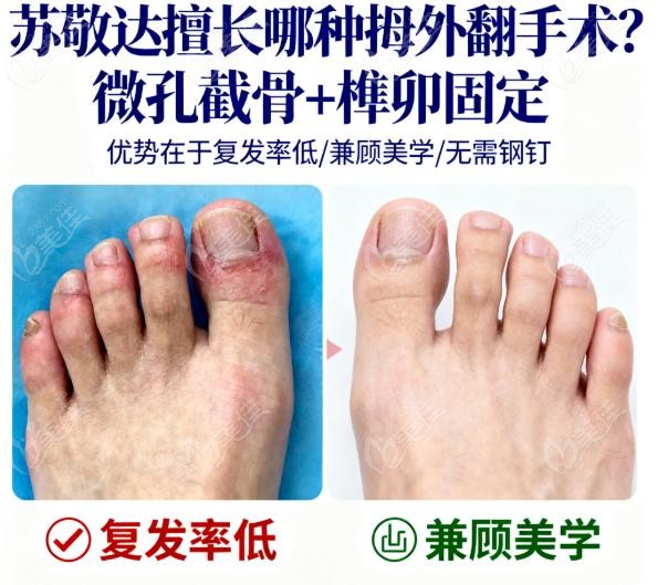 为什么说苏敬达这种技术"三赢"