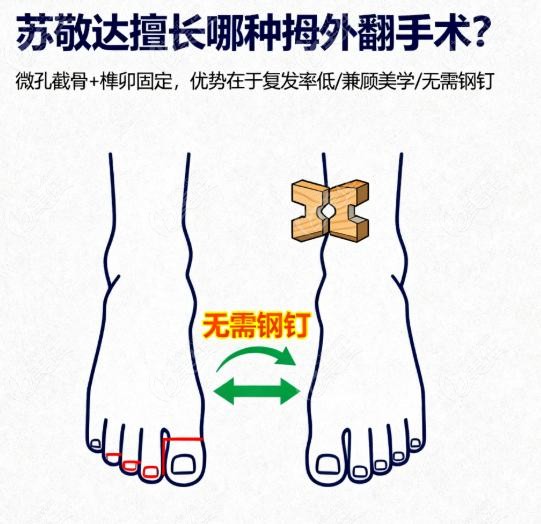 苏敬达为什么能做好这种技术