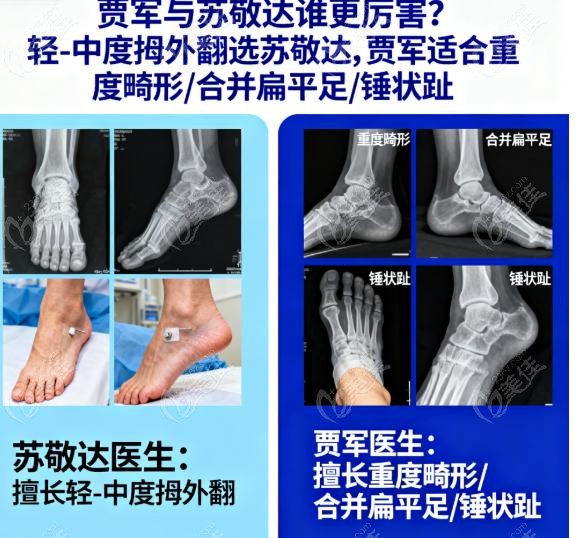 贾军与苏敬达谁更