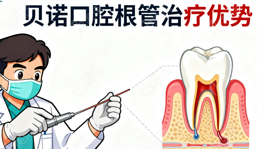 杭州贝诺口腔做根管靠谱
