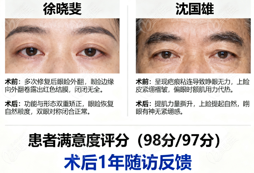 徐晓斐和沈国雄双眼皮
