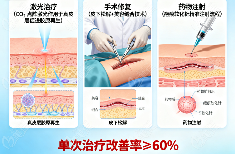 深圳鵬程醫院疤痕修复