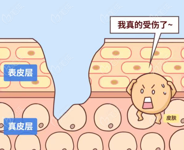 凹陷性疤痕修復(fù)的常見方法及價(jià)格