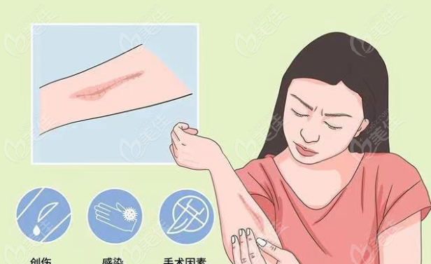 影響凹陷性疤痕修復(fù)價(jià)格的因素