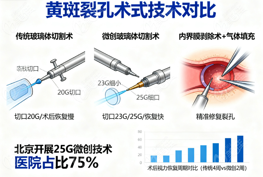 北京黄斑裂孔治疗医院推荐