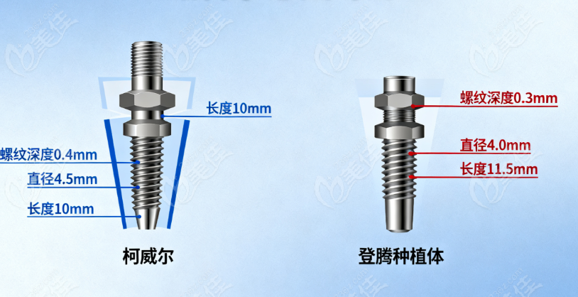 柯威尔种植体与登腾种植体区别