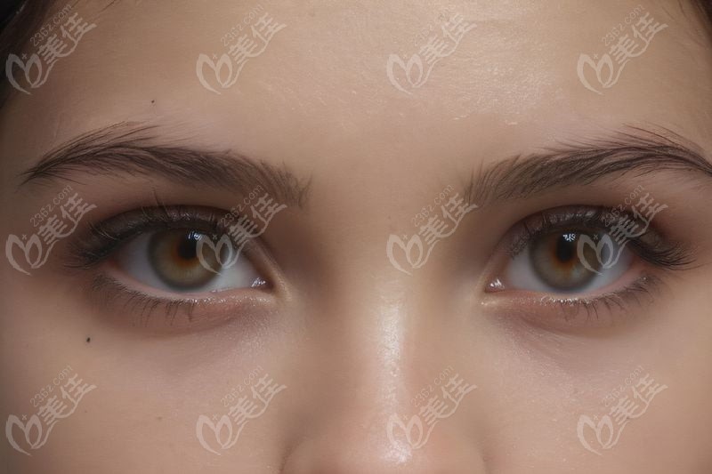 盤錦潤視眼科醫(yī)院服務號預約時間