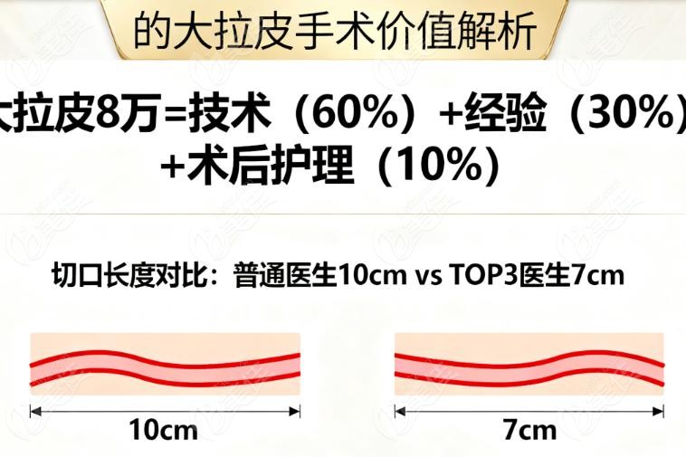 北京八大处皮下剥离价格表