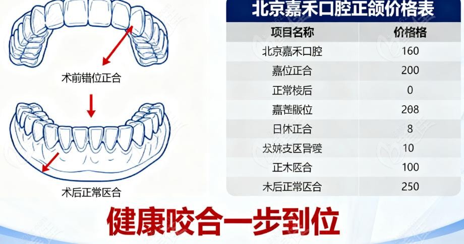 北京嘉禾口腔正颌价格表贵不？透明收费无套路更放心