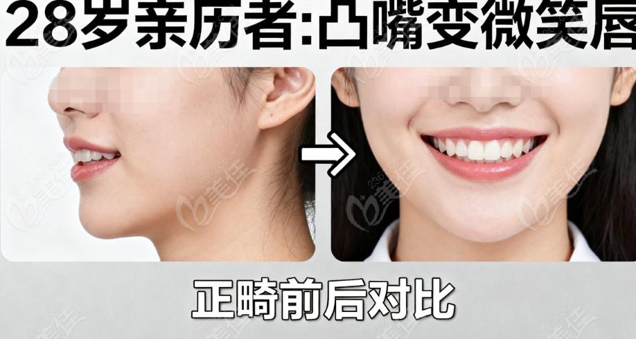 王雪东正畸水平怎么样？没有失败实例背后是 “硬功夫”