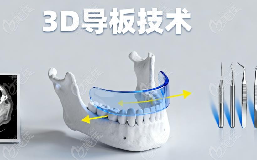 北大口腔李自力醫(yī)生擅長(zhǎng)什么手術(shù)