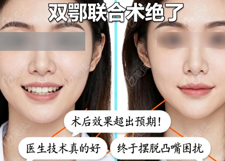 北大口腔醫(yī)院李自力跟哪個(gè)正畸科醫(yī)生合作