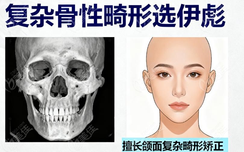 李自力和伊彪正颌技术对比：复杂 VS ，各有专攻