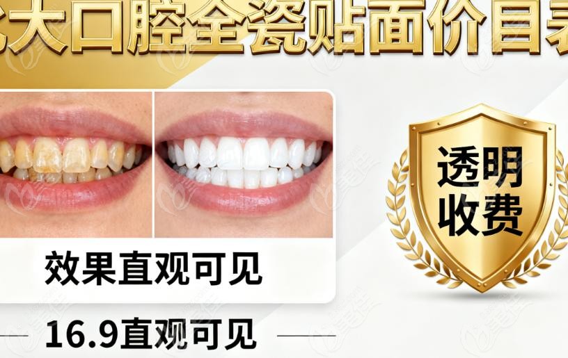 北大口腔全瓷贴面价目表