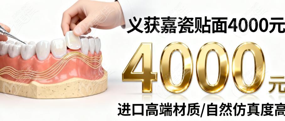 北大口腔瓷贴面成效怎么样？实例说话，这些问题都能解决