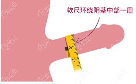 成都男性生殖器整形好的医院横向对比总结