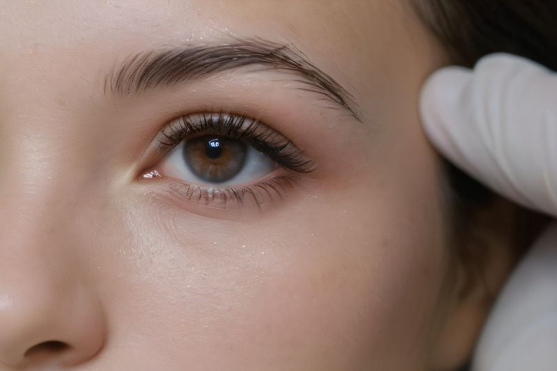 临沂光明眼科医院近视矫正手术技术优势