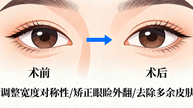 馬娟眼睛修復(fù)手術(shù)價格表