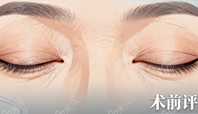 上海眼修復(fù)醫(yī)生馬娟正規(guī)預(yù)約