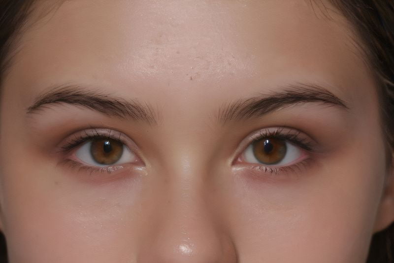 四、2025烏魯木齊普瑞眼科價(jià)目表：檢查到手術(shù)一次看清