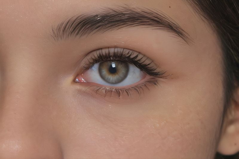 岳陽(yáng)愛(ài)爾眼科近視手術(shù)費(fèi)用表2025完整版：全飛秒3.0全包價(jià)17800元，無(wú)隱形消費(fèi)