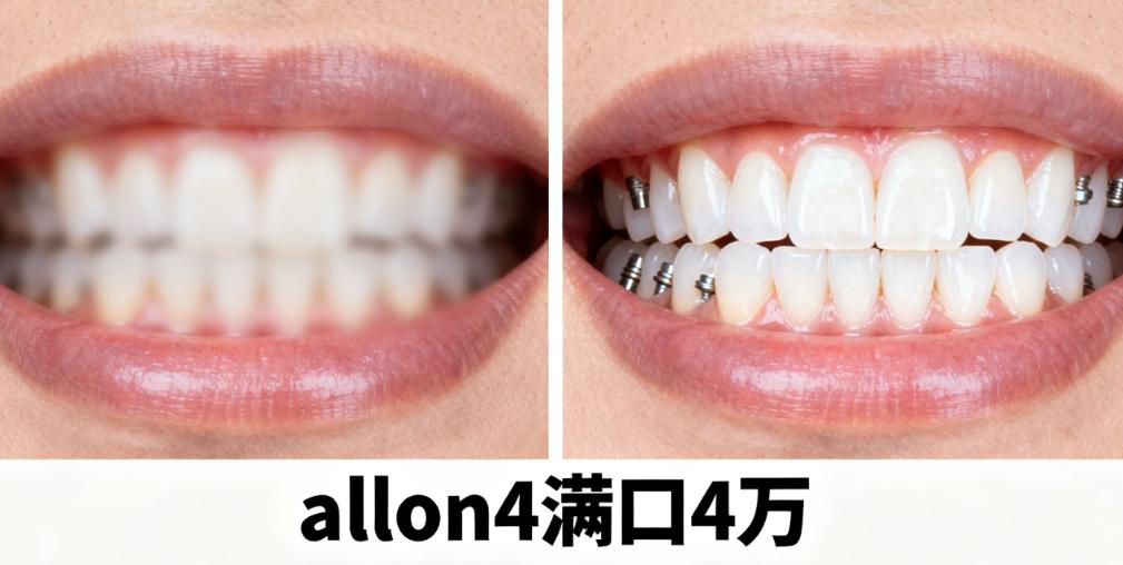 5G 數(shù)字化導(dǎo)板種植技術(shù)