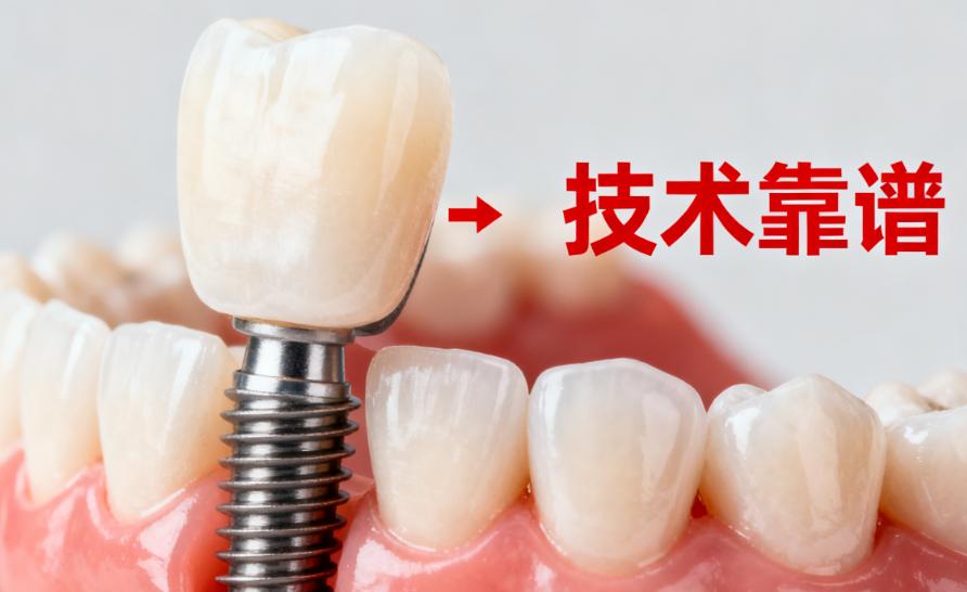 allon4 技術(shù)加持，中科領(lǐng)軍全口種植牙為什么更靠譜