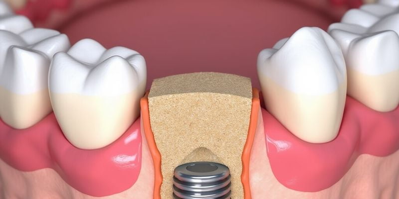 福華口腔醫(yī)院預(yù)約時(shí)間表及預(yù)約方式