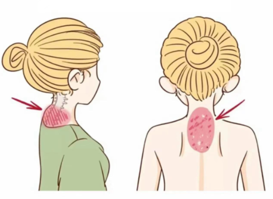 遼陽市中心醫(yī)院富貴包手術(shù)就診攻略