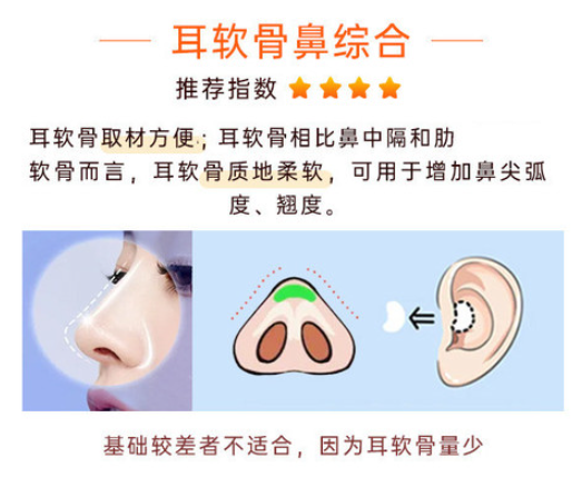 張鵬保留鼻能維持多久？