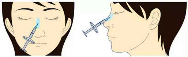 德瑪玻尿酸大致價格