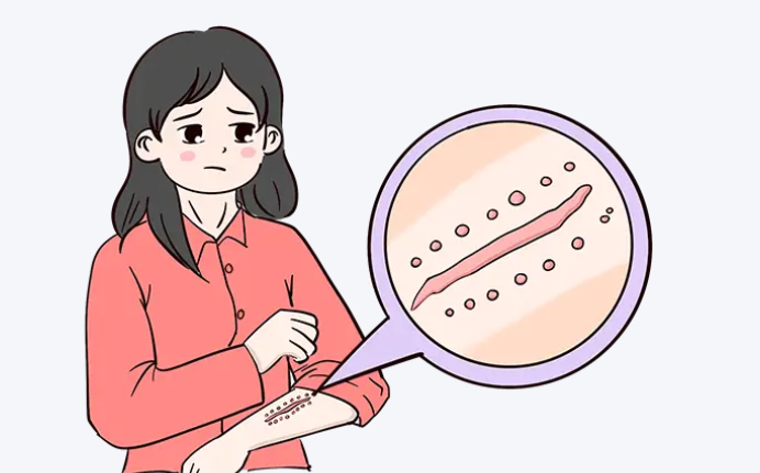 韓國安成烈祛手術(shù)疤多少錢