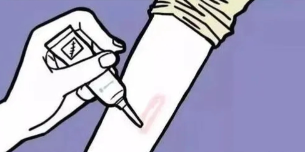 安成烈整形外科祛疤優(yōu)勢及技術(shù)特點