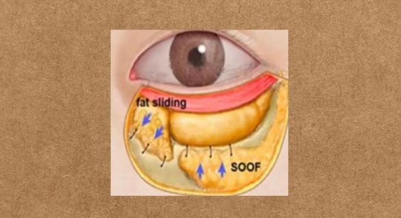 西安伊美爾去眼袋醫(yī)生