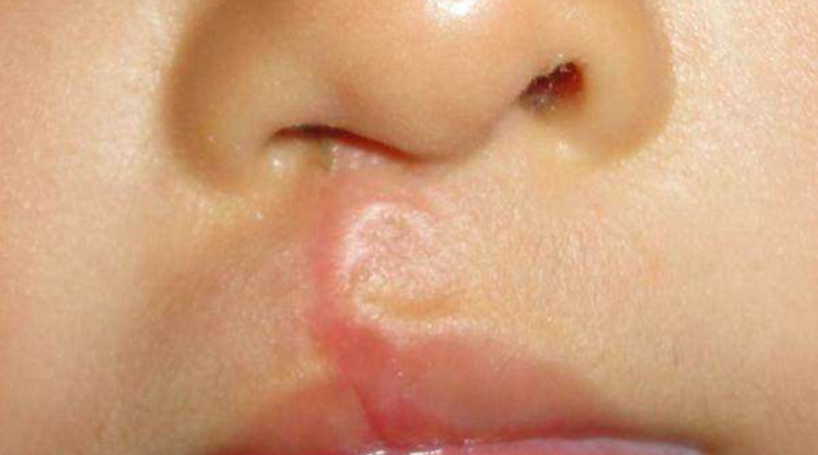 手術(shù)特點與技術(shù)創(chuàng)新