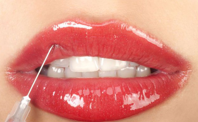 上海做唇部整形常見項目的醫(yī)生推薦