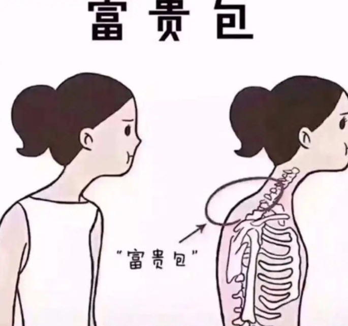 李方偉富貴包微創(chuàng)術(shù)手術(shù)流程