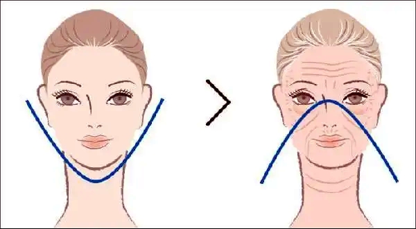 上海中下臉拉提醫(yī)院www.pfflawyer.com