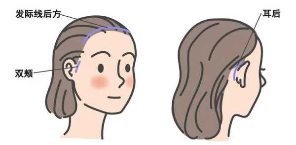 上海中下臉拉提醫(yī)院網(wǎng)友實(shí)測(cè)實(shí)例